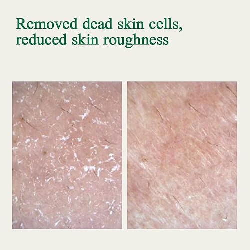 Miniatura 5 de PYUNKANG YUL Ampolla Ultimate Calming Solution con manteca de karité, flor de madreselva, ceramidas, CICA para calmar rápidamente, hidratar la piel