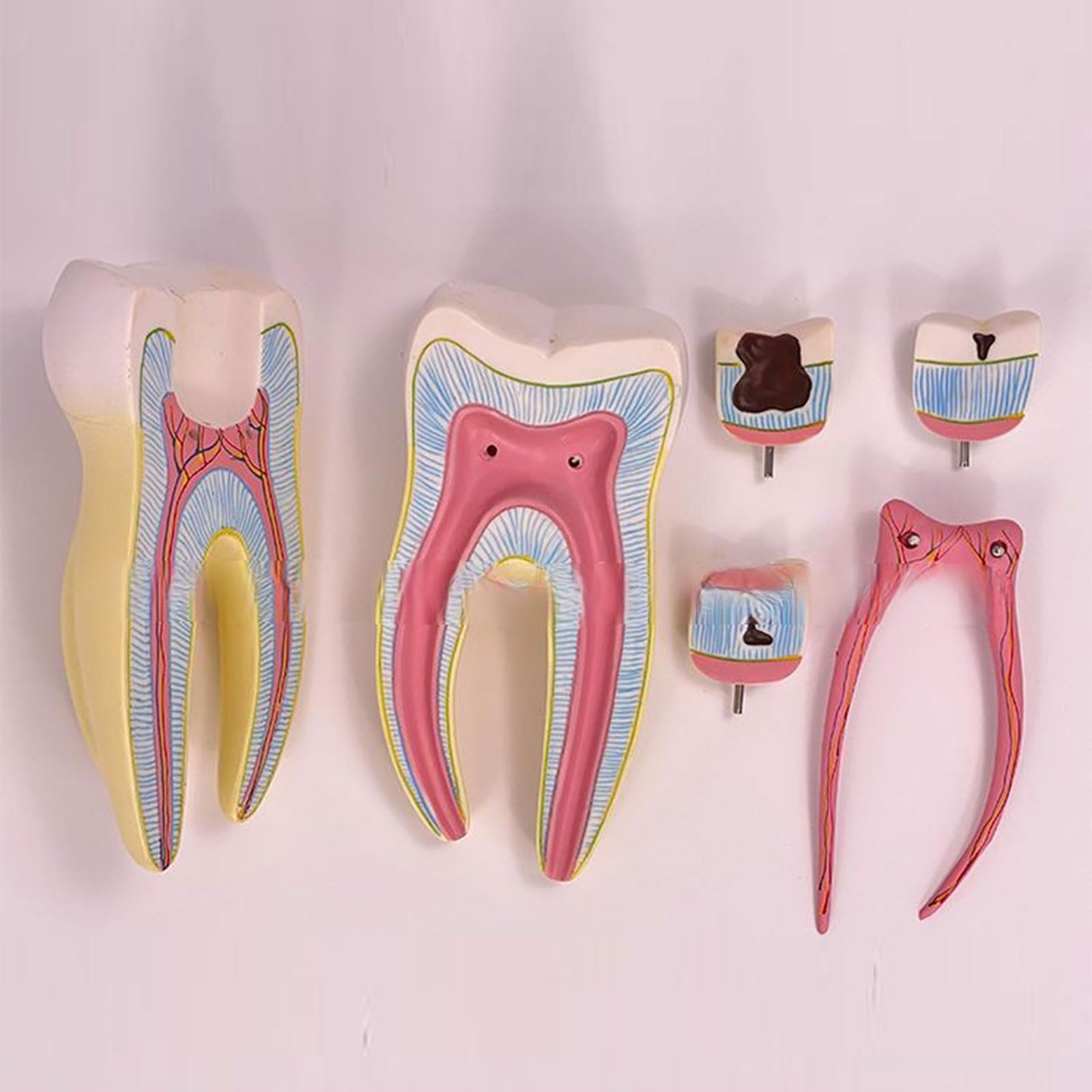 Modèle anatomique dentaire Molar Anatomie dentaire Modèle avec pièces amovibles Modèle dentaire humain pour étude des maladies dentaires
