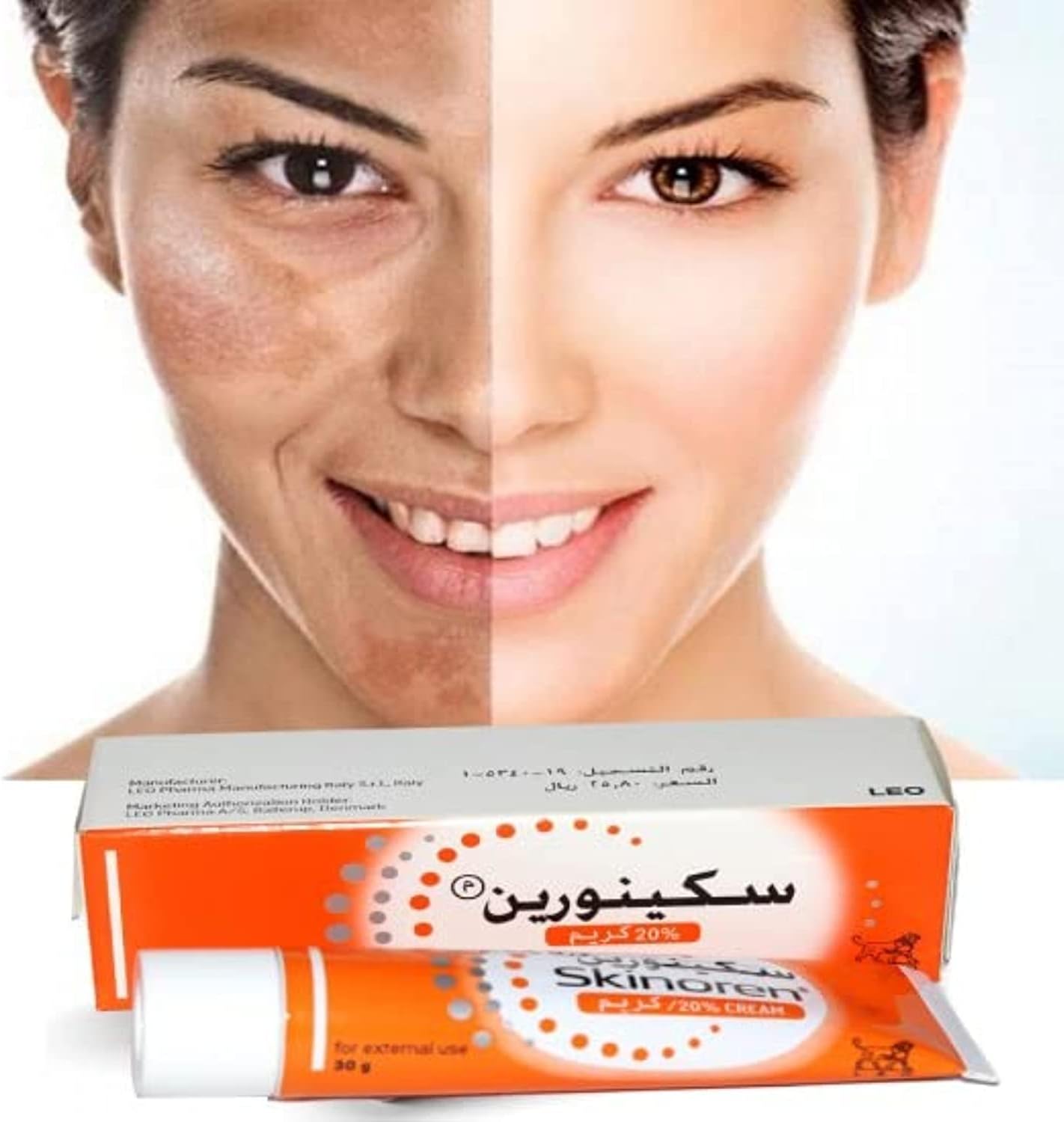 BAYER Skinoren Whitening Cream 30g Buy Online at Best Price in Egypt