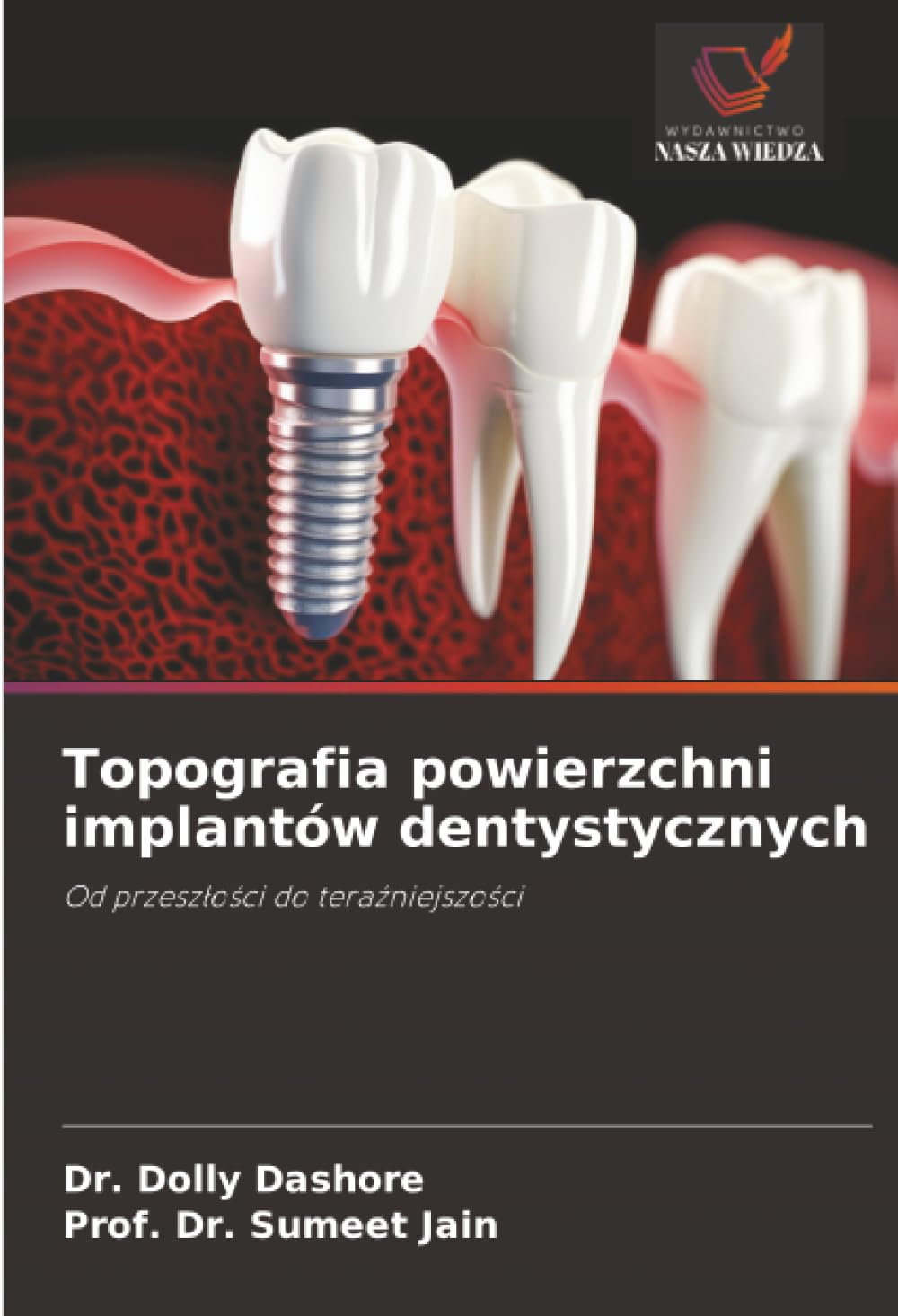 Topografia powierzchni implantów dentystycznych: Od przeszłości do teraźniejszości: Od przesz¿o¿ci do tera¿niejszo¿ci