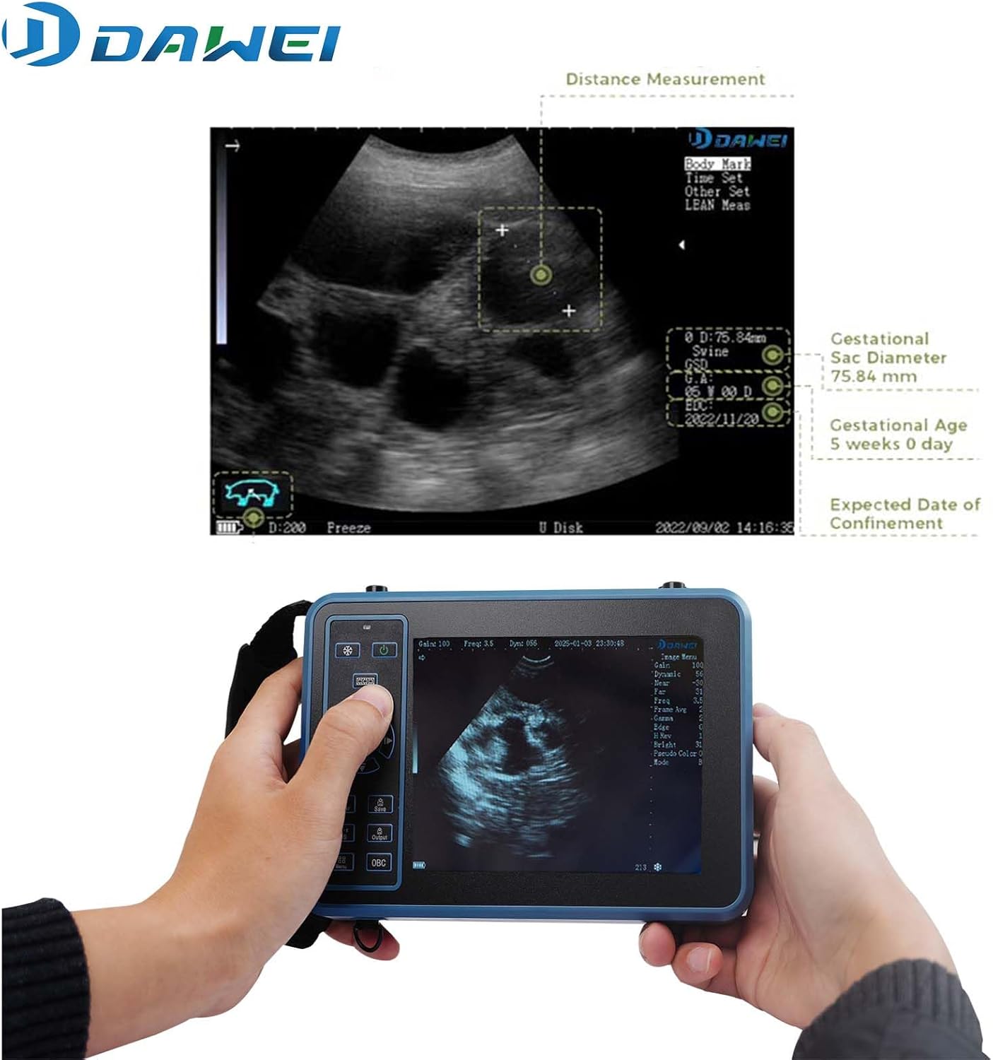 DAWEI Vet Ultrasound Machine for Pregnancy Veterinary Ultrasound Scanner with 3.5Mhz Convex Probe for Sheep，Goat,Pig