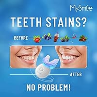 Vista 3 de Kit de blanqueamiento de dientes MySmile con luz LED, blanqueador rápido para no sensibles dientes en 10 minutos con 3 gel blanqueador de dientes