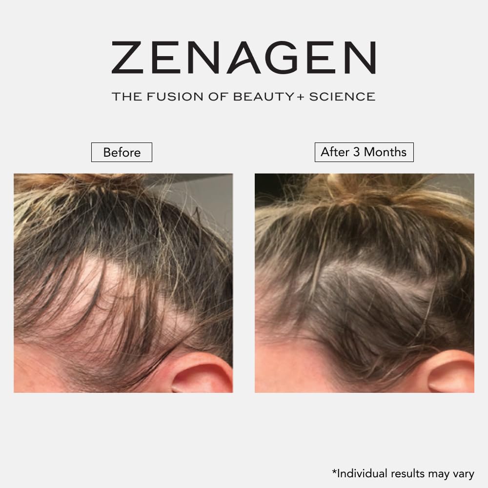 Zenagen Revolve Thickening Shampoo & Conditioner Bundle for Women, 13.5 oz