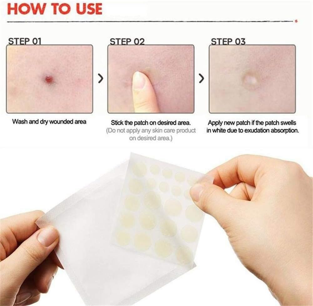 Acne patches, spot hydrocolloid, acne pimple master patch, pimple patch
