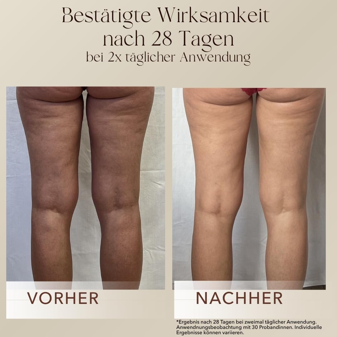mellow NOIR Body Contour Cream 200ml – Körpercreme gegen Cellulite und Schlaffe Haut – Für feste Konturen an Bauch, Beinen und Oberarmen – zieht schnell ein ohne zu fetten – Naturkosmetik - vegan