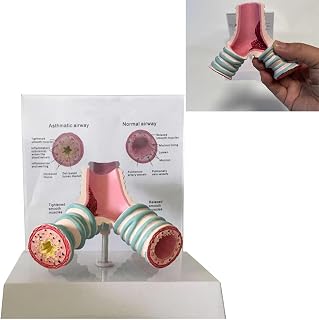 Professional Asthma Anatomy Model with Stand & Bilingual Plate - Human Respiratory Bronchial Display for Medical Teaching Major-Grade PVC Clinical Training & Communication Aid