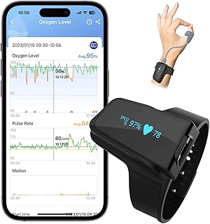 ViATOM Pulsioxímetro profissional com Bluetooth, monitor de sono portátil de pulso com alarme, medidor de oxigénio sanguíneo de monitorização contínua com relatório compartilhável