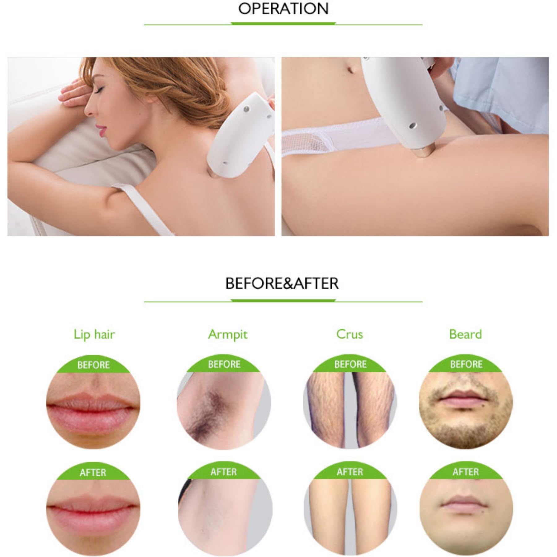 4000W 808nm diodo laser depilatore punto di raffreddamento corpo facciale ascelle depilazione permanente 4 lunghezza d'onda 755nm 808nm 940nm 1064nm certificazione CE