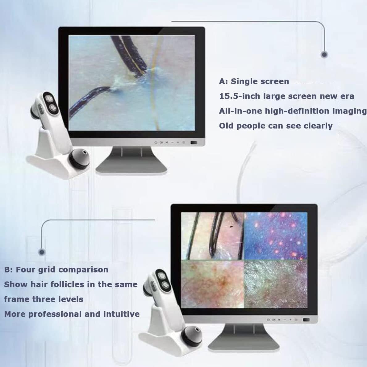 15.5-Inch Digital Skin & Hair Analyzer,with 50X/200X Dual Probe, HD LCD Screen For Scalp, Acne, Pore Detection - Salon & Home Use
