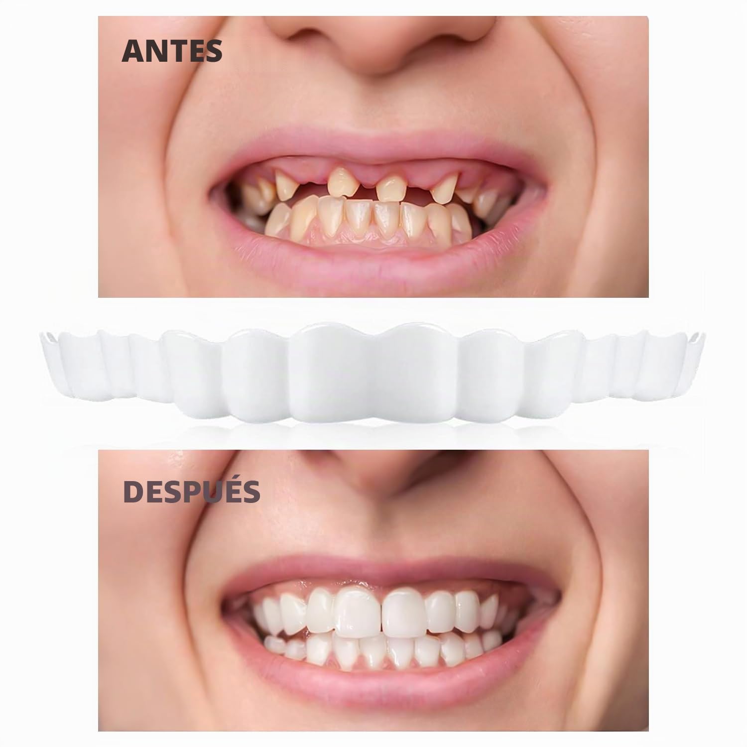 Dientes Postizos Temporales, 2 pares Dentaduras Postizas Instantáneas, Carillas Dentales, Dentadura Postiza Perfecta, Dentaduras Postizas Ajustables, Dientes Postizos, para Hombres Mujeres