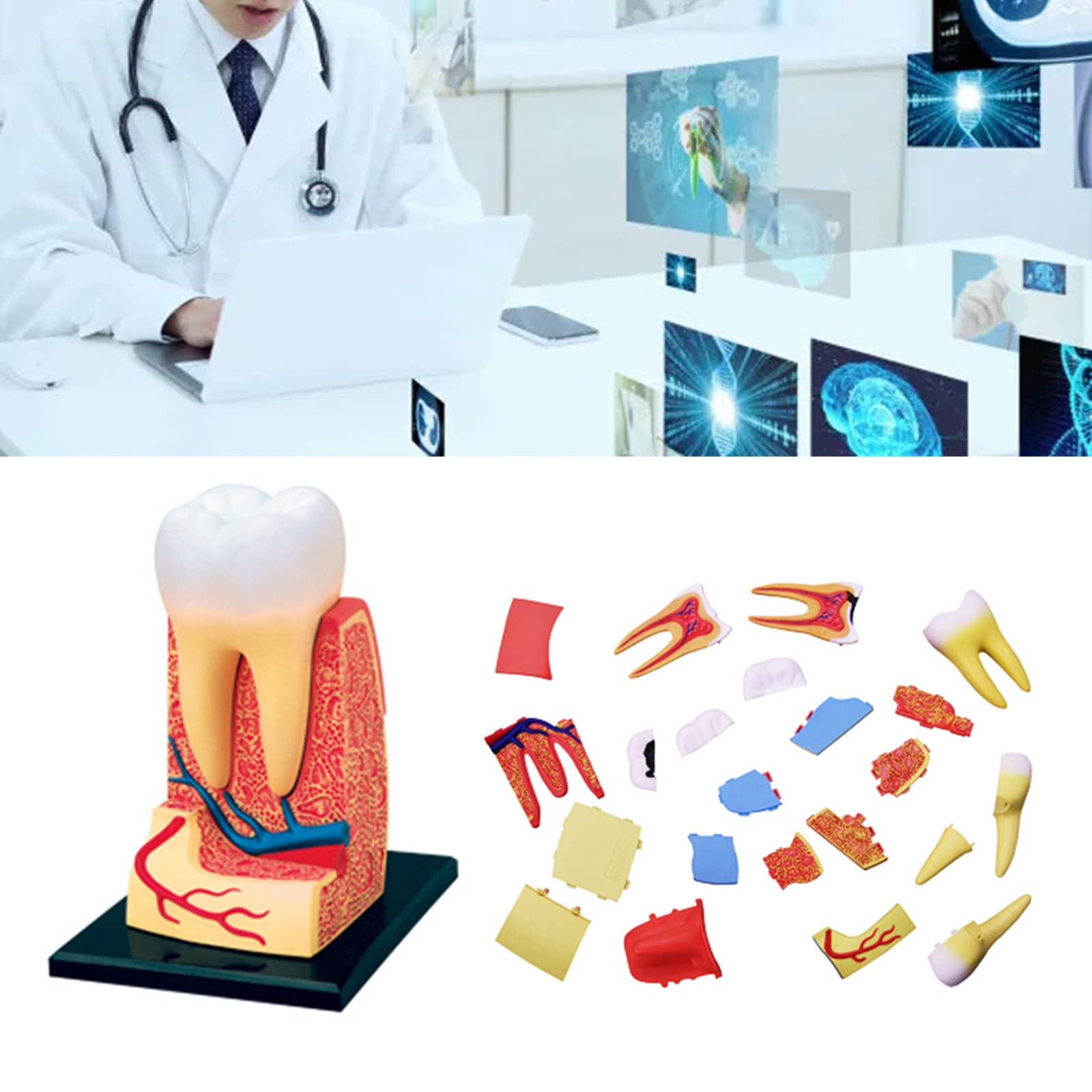 Aouzsta Teeth Anatomy Model Removable Analysis Bridge Demonstration Teeth Model for Class Education and Studying