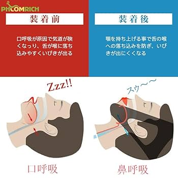 いびき防止グッズ いびき対策 口呼吸防止 鼻呼吸促進 調整可能 男女兼用 Amazon.co.jp: いびき防止グッズ 口呼吸防止 いびきを減らし 喉