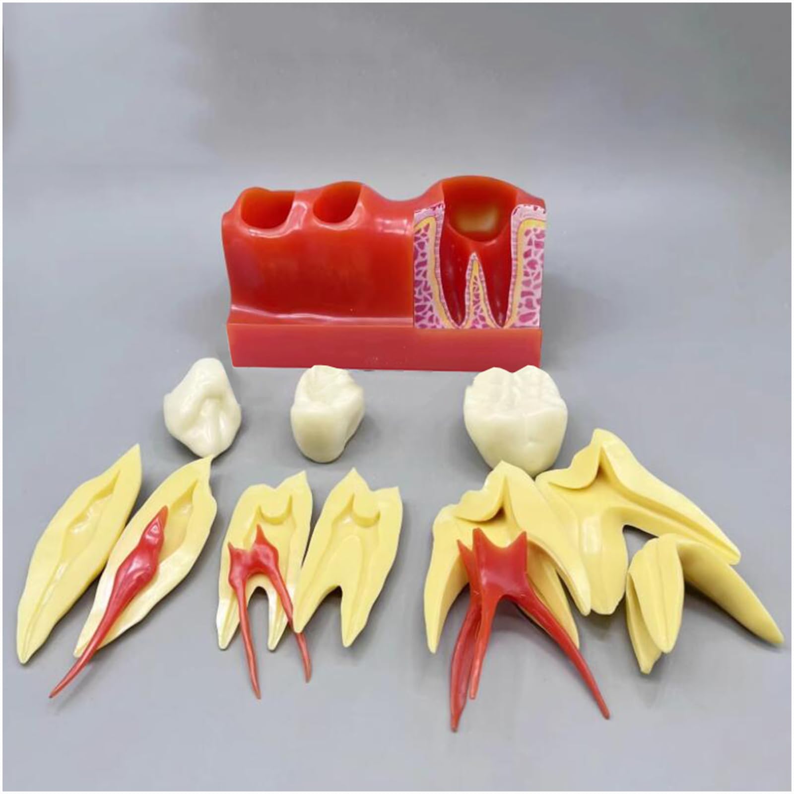 4-Faches Zahnimplantat-Modell – Zahnarztpraxis Implantat-Modell – Für Labor-Dental, Pädagogische Analyse