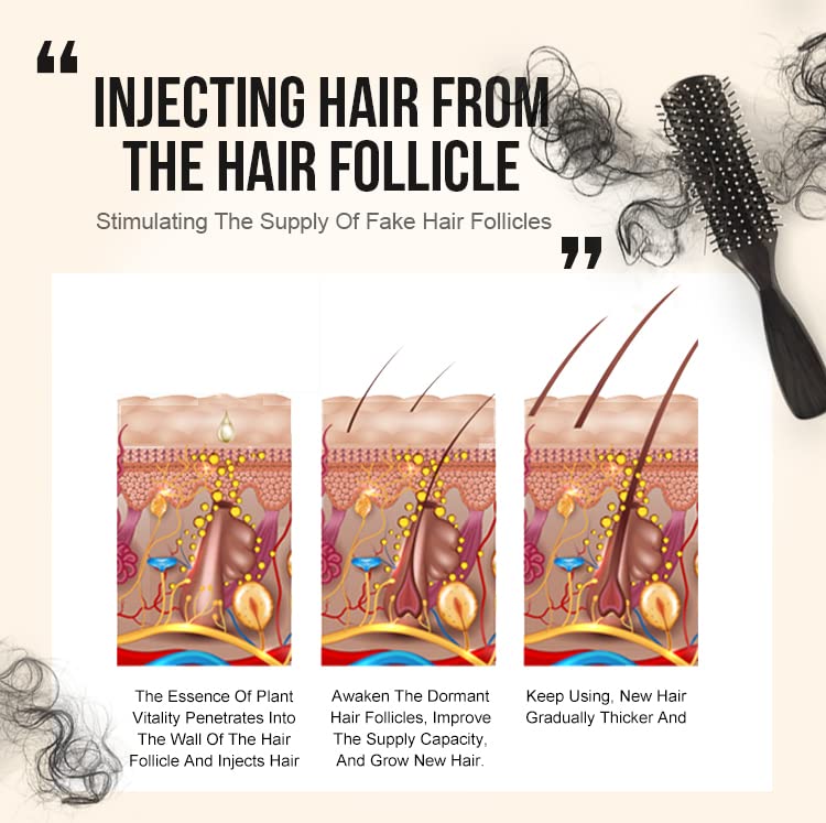 50ml-Ginger-Hair-Density-Growth-Essential-Oil-Repair-Hair-Nourishing-Hair-Care-Anti-Hair-Loss-Hair-Growth-Conditioning-Scalp-Essential-Oil-2PCS