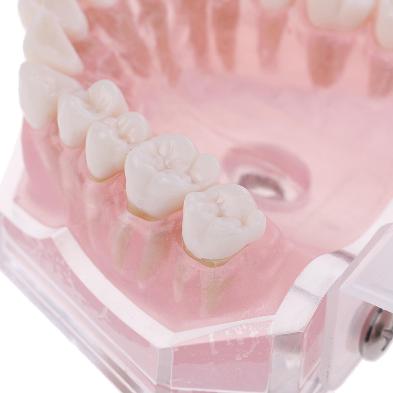 Modelo dental con dientes extraíbles, bandeja suave estándar, modelo dental extraíble, herramienta de enseñanza de materiales de laboratorio dental ideal