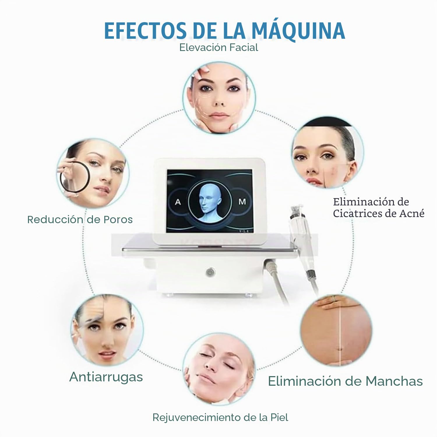 Máquina Microagujas Rf Para Lifting Facial, Reafirmante Piel, Eliminación De Estrías Rejuvenecimiento Piel Con 2 Asas, Para Terapia De Eliminación Arrugas Y Belleza Facial