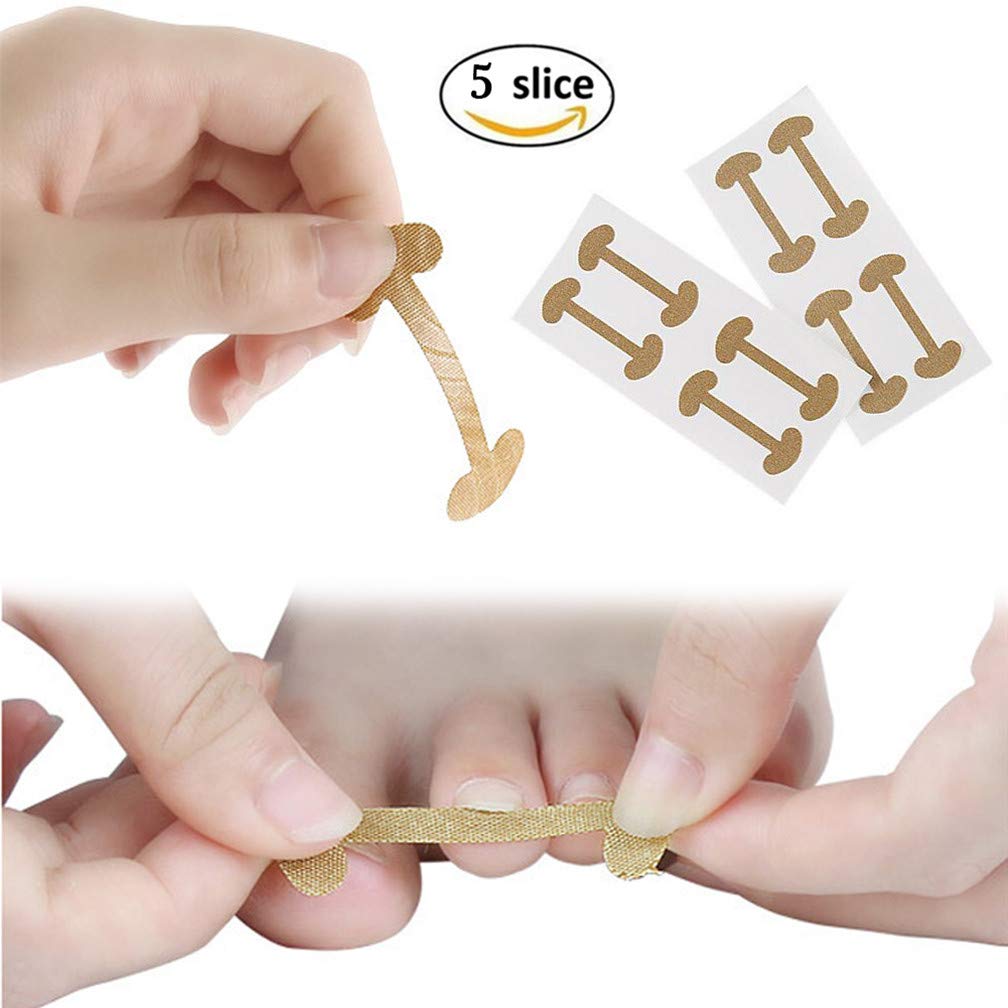 Buy Ingrown Toenails Correction Patch, Physical Straightening Toenail