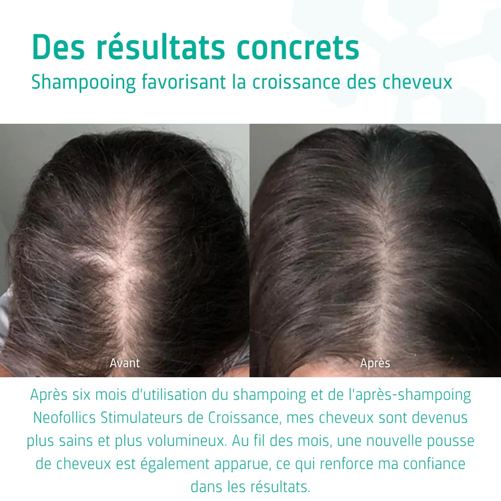 Neofollics Shampooing stimulant la croissance des cheveux
