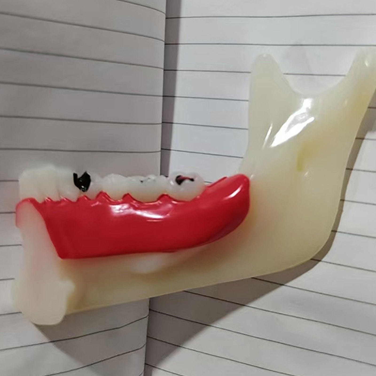 Modello di denti Typodont per l'educazione orale, strumento dimostrativo per lo studio della carie e della cisti radicale, aiuto didattico anatomico per dentisti