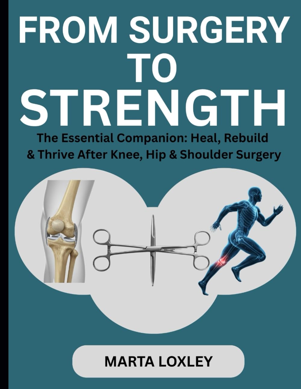 FROM SURGERY TO STRENGTH: The Essential Companion: Heal, Rebuild & Thrive After Knee, Hip & Shoulder Surgery