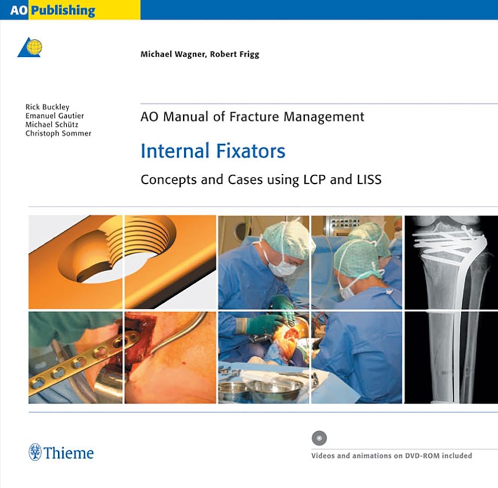 Buy AO Manual of Fracture Management: Internal Fixators: Concepts