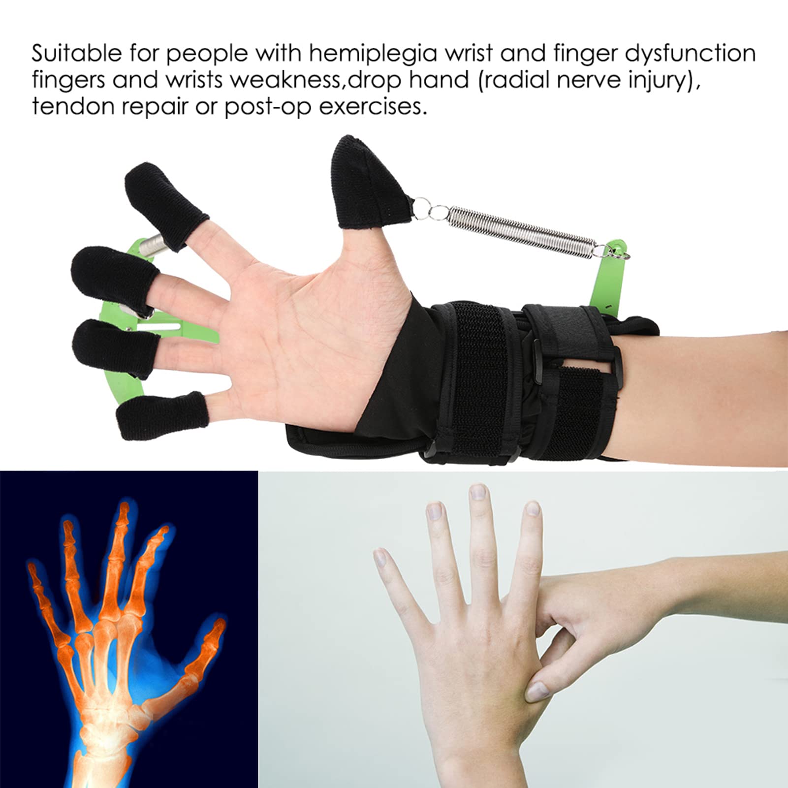 Ortesis Ajustables para Muñeca y Dedos, Dispositivo de Entrenamiento para Pacientes con Disfunción de la Mano, Hemiplejia por Accidente Cerebrovascular, Entrenamiento con Dedos de Las Manos