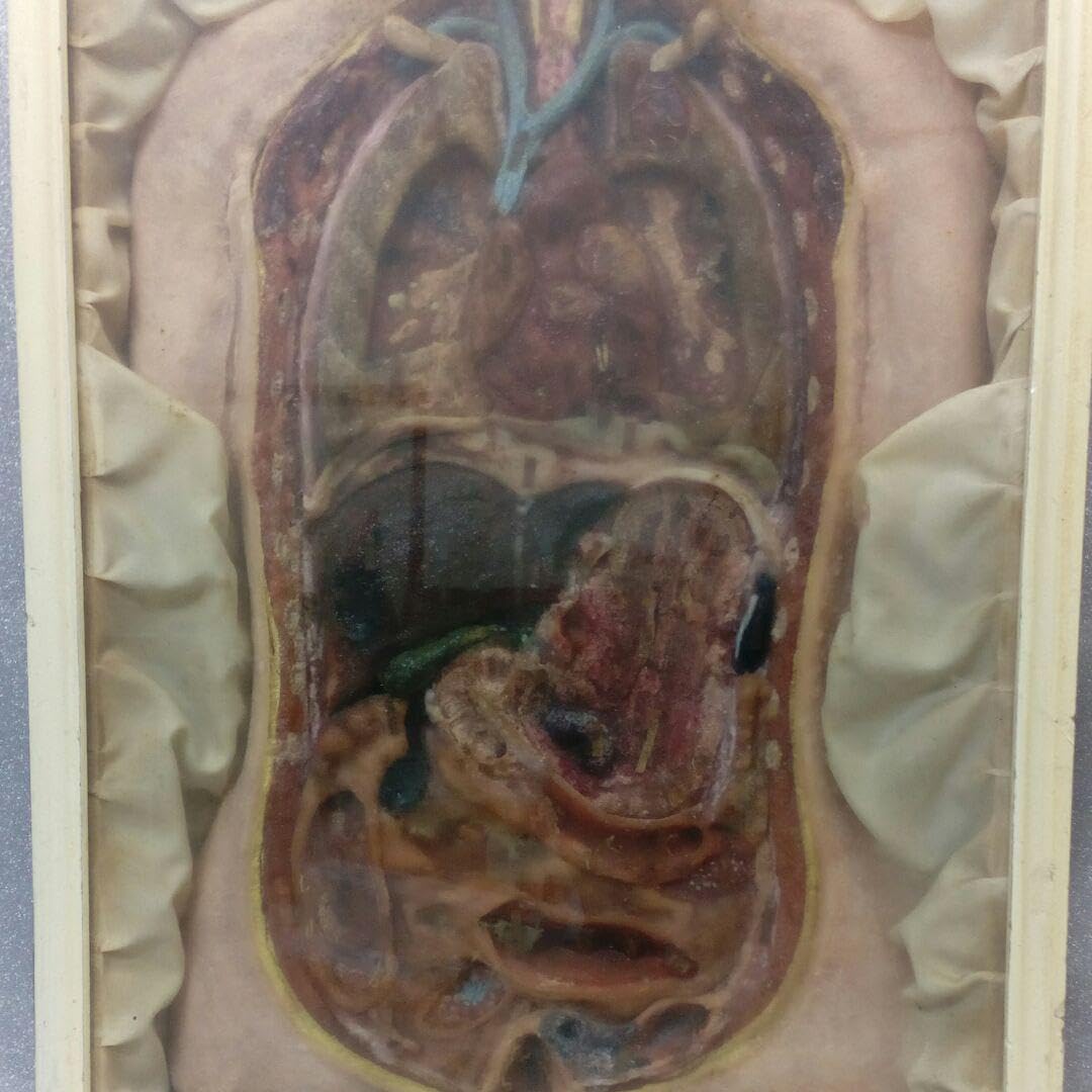 珍品、レトロ医学模型寄生虫