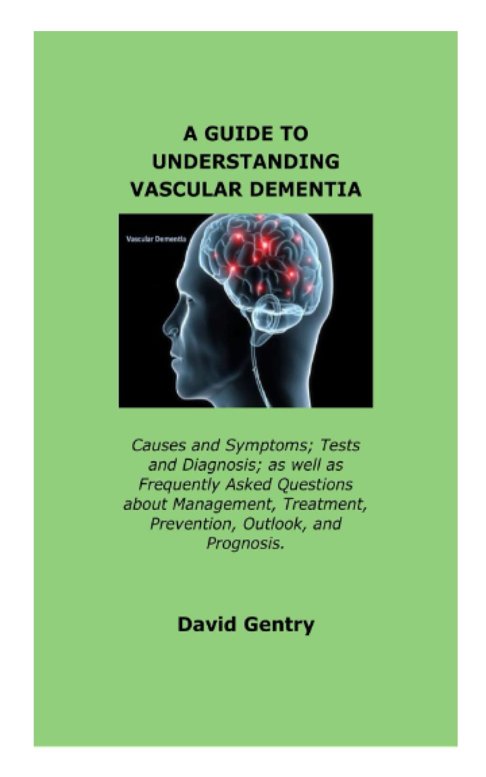 A GUIDE TO UNDERSTANDING VASCULAR DEMENTIA: Causes and Symptoms; Tests and Diagnosis; as well as Frequently Asked Questions about Management, Treatment, Prevention, Outlook, and Prognosis.