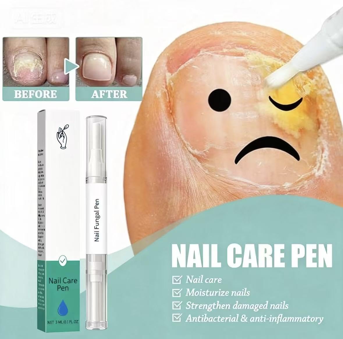 Anti Fungal Pen