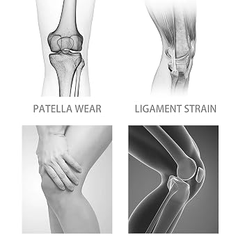 Knee Braces for Knee Pain, Sleeve Brace for Knee Pain Bone on Bone, Knee Compression Sleeve with Patella TPE Pad & Side Stabilizers for Women Men (2*Black, XL)