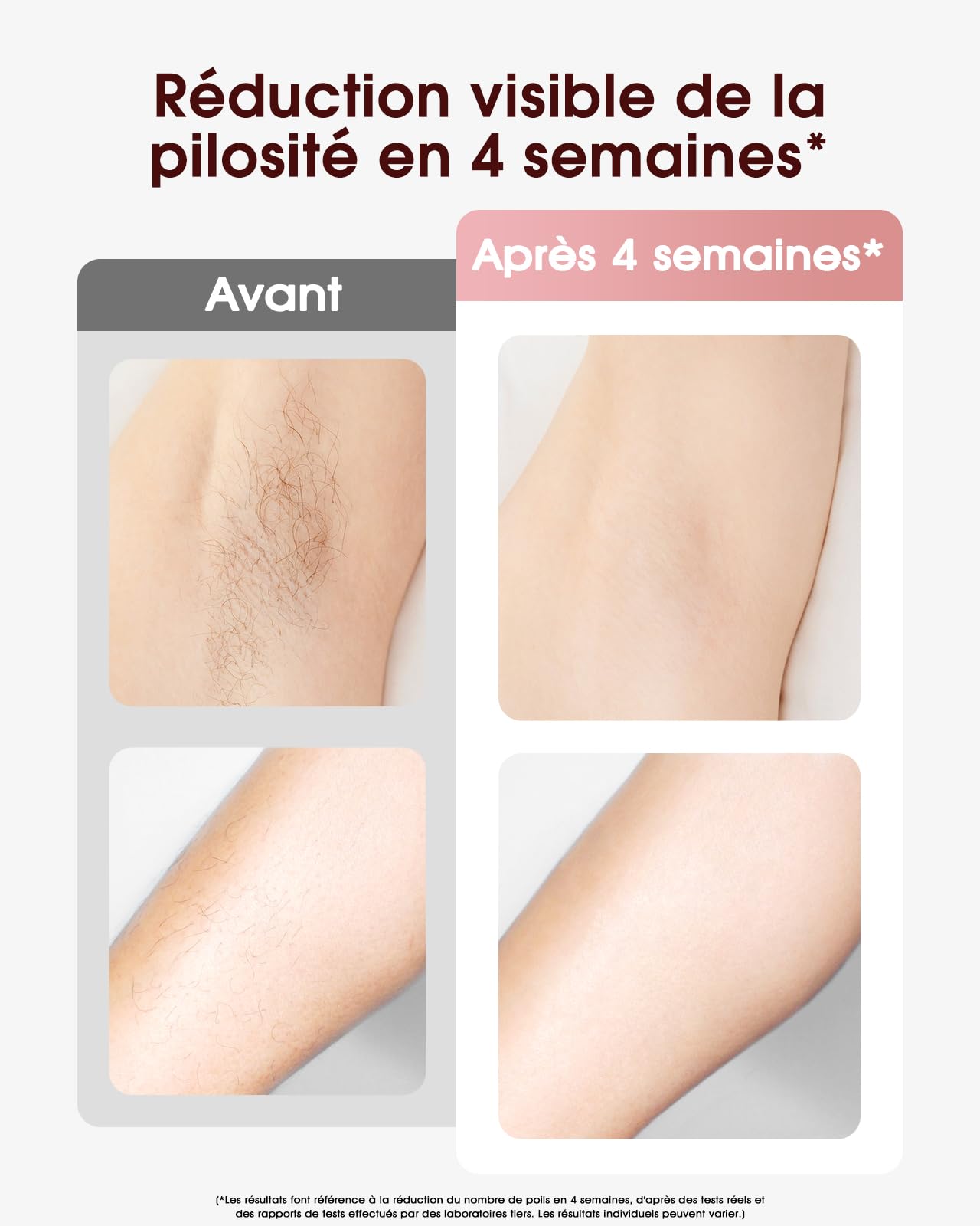 Haarlosy Épilateur Lumière Pulsée de Refroidissement, 999,900 Flashes IPL Laser Épilateur Definitive, 2 Modes 5 Niveaux Énergie Épilation Laser pour Visage/Corps/Maillot/Aisselles, IFE04