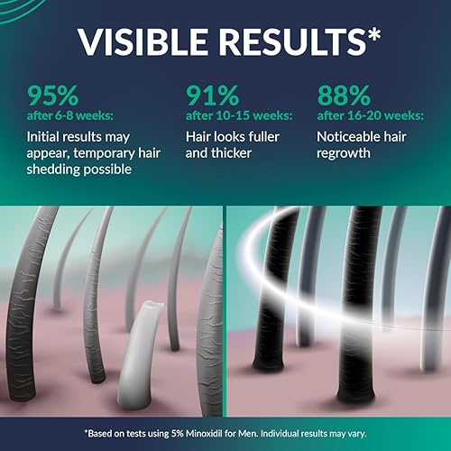 Miniatura 6 de Minoxidil para hombres 5%  Crecimiento del cabello, kit de crecimiento de barba Minoxidil 5 por ciento + vitamina E, ginseng, extracto de jengibre,