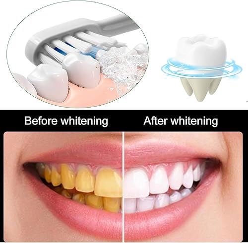 Miniatura 3 de Sp10 Probiotic Ultra Whitening Pasta de dientes (3 unidades)