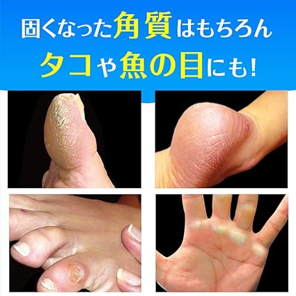 Amazon タコトリーs ベストバリュー 魚の目削り 角質やすり 通販