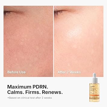 Genabelle PDRN Vitamin C Serum Toning Ampoule - Lightweight Glass Skin,korean skin care with Vitamin B, C, E, PDRN, Serum for Blemishes, Glass Skin, Fine Lines and Rough Skin Texture, 1.01 fl oz