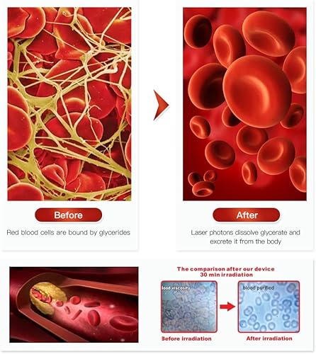 Miniatura 6 de Red LLLT - Pulsera de tratamiento, regalos de Acción de Gracias para niños y mayores, reloj de pulsera de terapia LLLT con puerto de oreja y nariz