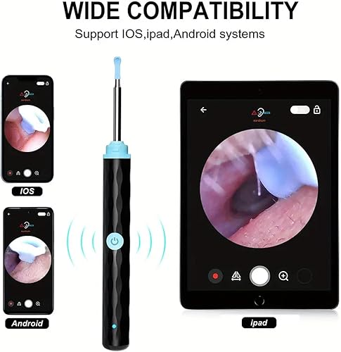 Miniatura 4 de Zone Flex - Eliminación de cera de oídos, cámara Fonenyca 2024 de 1080p, limpiador de cera de oídos Fonenyca, eliminación de cera de oído Loft Pro,