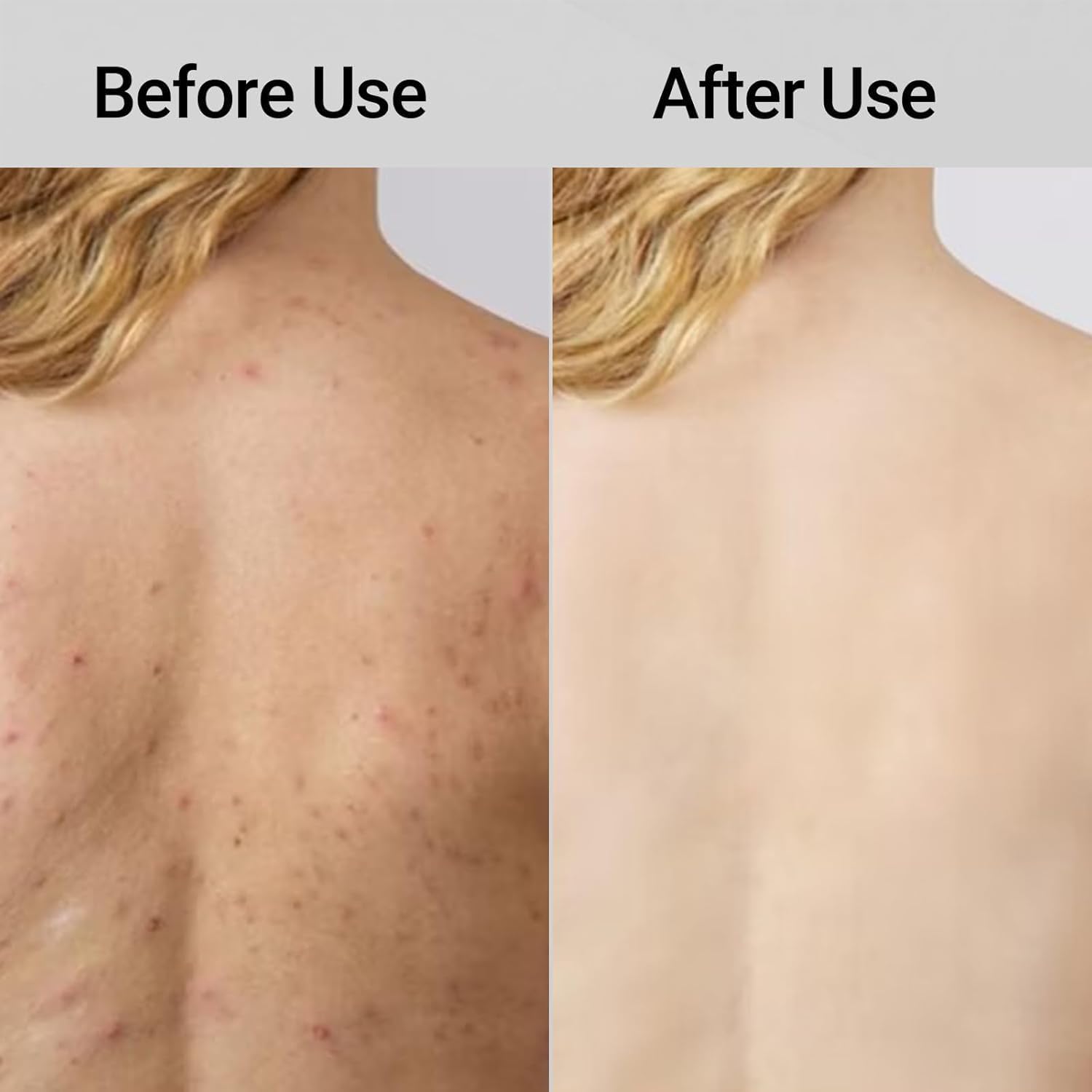 Exfoliating Shower Towel, 2-in-1 Towel, Premium Scrub Wash Cloth for Body Face, Exfoliating Towels-Body Scrubber with 2 Sides for All Skin Types - Image 7