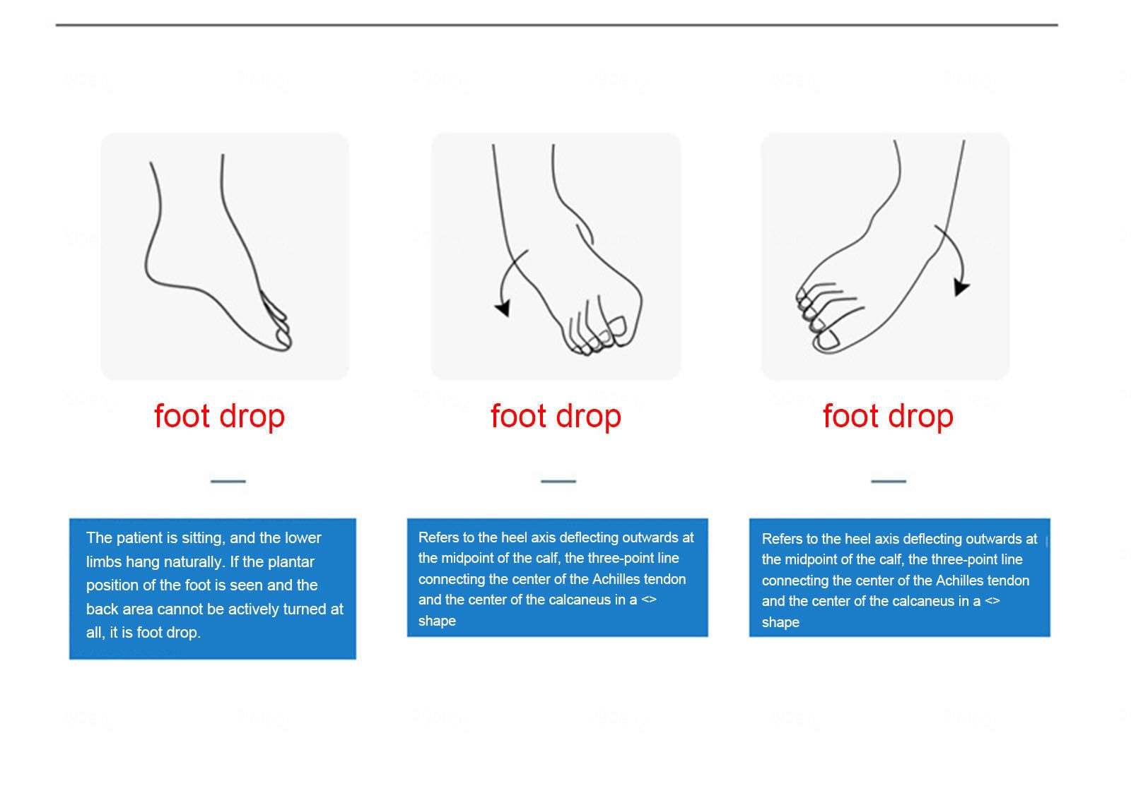 VIDECOR AFO Drop Foot Tutore - 2023 Supporto Medico Aggiornato per Ortesi Piede Caviglia Piede per Emiplegia Stroke Shoes Walking Foot Stabilizer,Right-Small