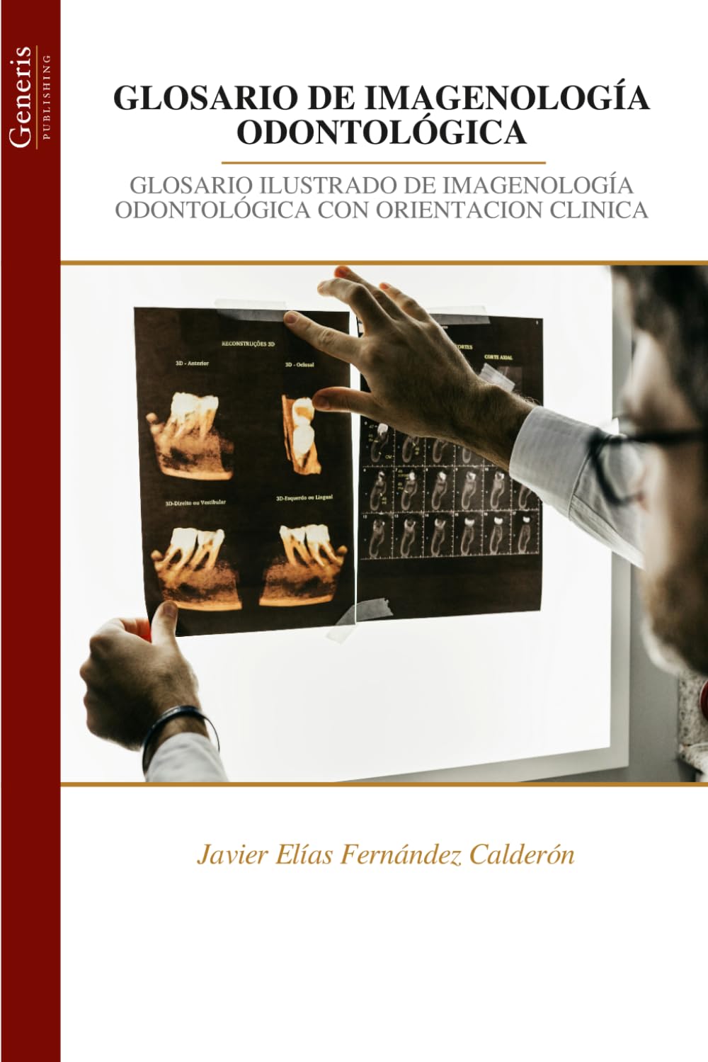 GLOSARIO DE IMAGENOLOGÍA ODONTOLÓGICA: GLOSARIO ILUSTRADO DE IMAGENOLOGÍA ODONTOLÓGICA CON ORIENTACION CLINICA