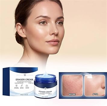 2PCS Picdo Skin Tag Remover Cream,Picdo 7-Day Skin Tag Spot Eraser Cream, Smoothing & Moisturizing, Suitable for Face and Body
