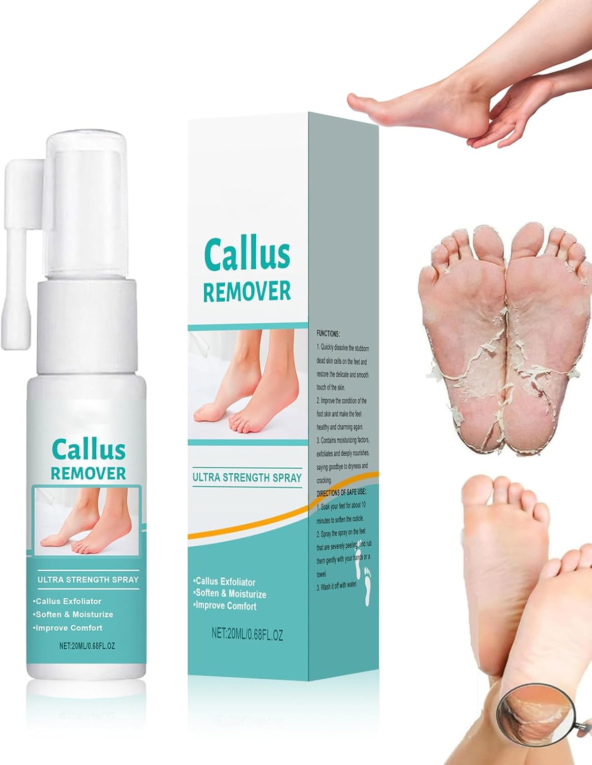 Professional Callus Remover, Extra Strong Spray, Foot Peeling Spray, Effective Callus Removal, Dead Skin for Smooth, Cared for Feet (1 Piece, 20 ml)