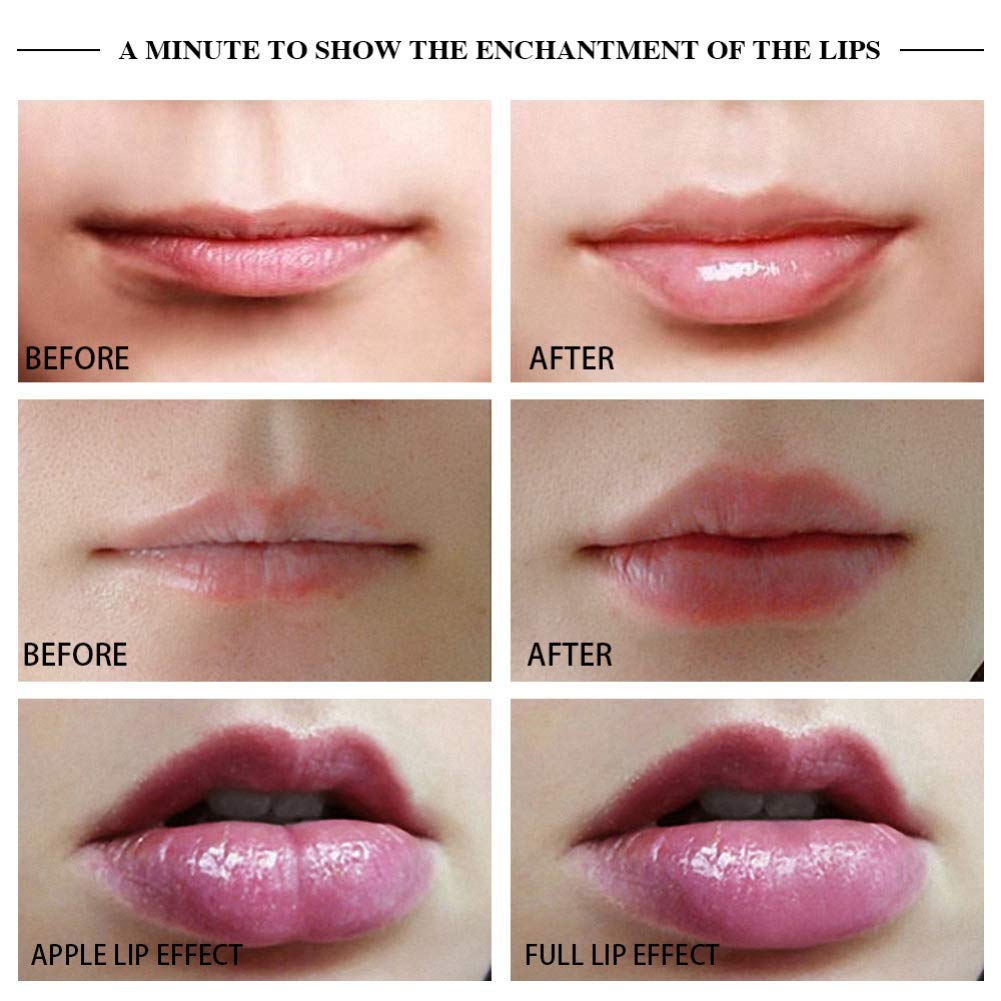 Lips Enhancer Lip Pump Plumper Lèvres électriques Agrandir Pompe à lèvres Sexy Enhancer pour lèvres Plus pulpeuse