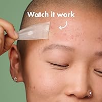 Vista 5 de Hero Cosmetics Mighty Patch™ Parche original de 36 unidades y parche de superficie Mighty Patch™ paquete de 10