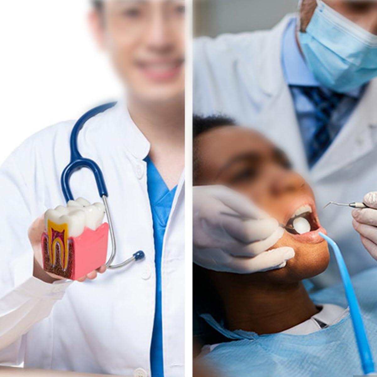 Sarini Modèle Dentaire, modèle d'étude de comparaison des Caries, modèle d'enseignement de l'anatomie Dentaire pour dentistes, adapté aux dentistes, aux Patients, aux Enseignants et aux étudiants