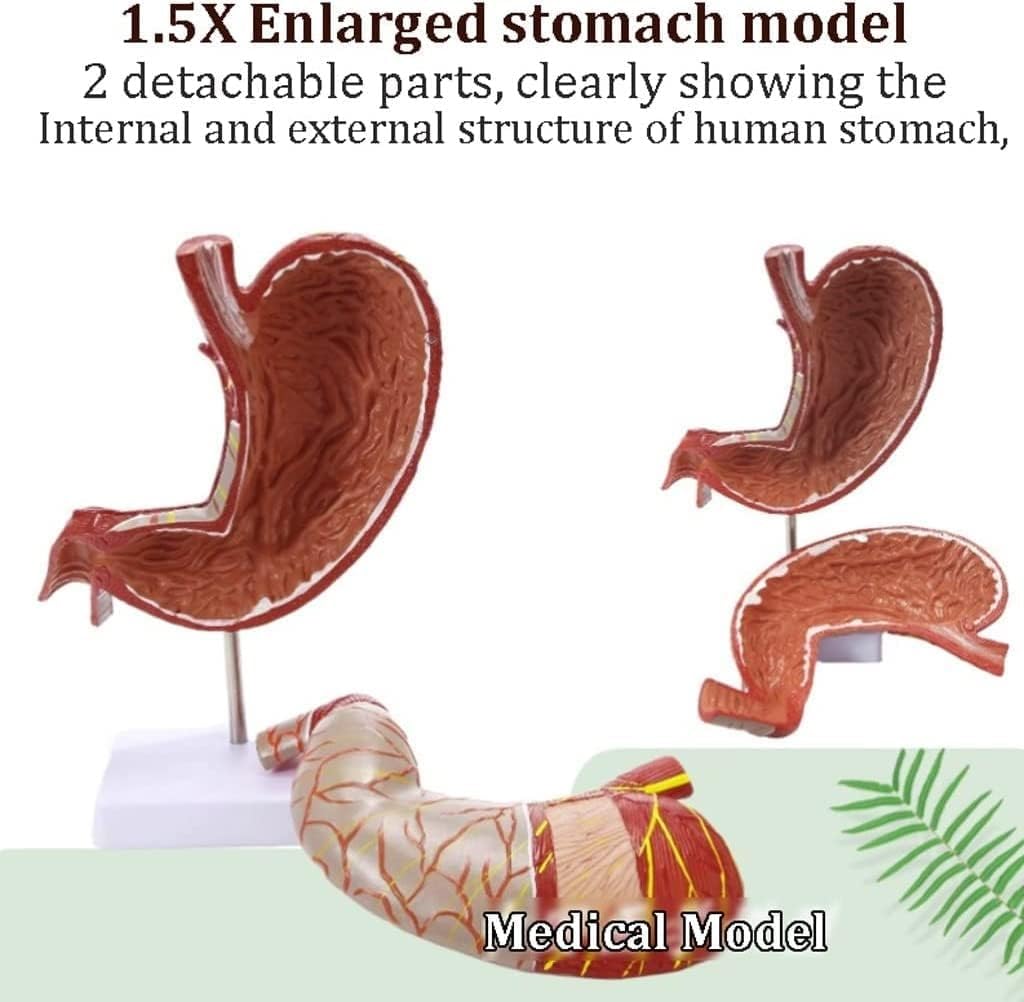 Anatomiemodell des menschlichen Magens, 1,5-fach vergrößertes Modell der Magenanatomiestruktur mit 2 abnehmbaren Teilen, realistische Lehrhilfe for menschliche Organe for den medizinischen