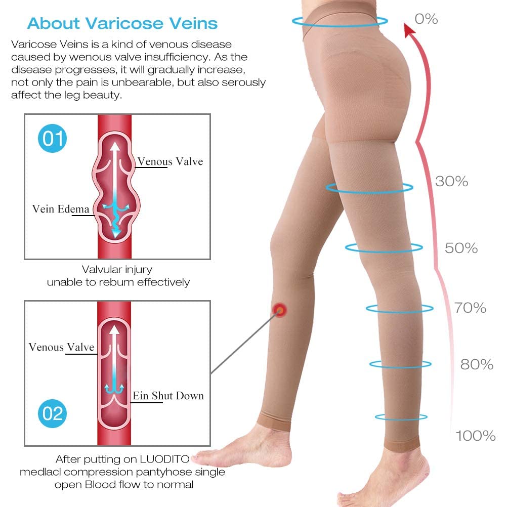 Medias de compresión médicas para mujer 20-30 mmhg, medias de compresión opacas, manguera de apoyo graduada para venas vercosas edema presión gradiente, XL, Color beige.