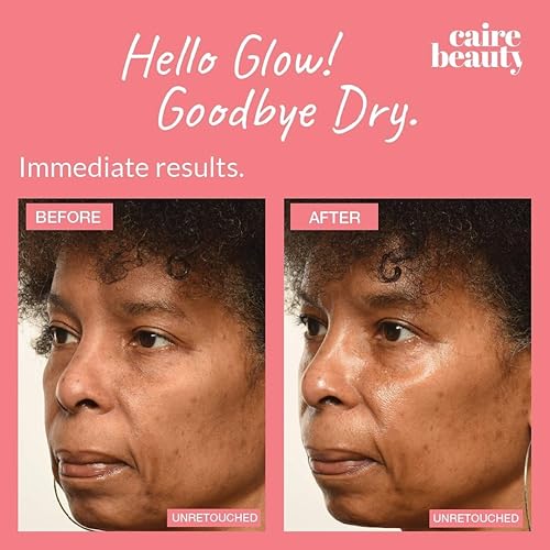 Miniatura 4 de Caire Máscara de molécula de gel de ácido hialurónico antienvejecimiento, mascarilla de molécula de elevación de cara, gel hidratante para cara,