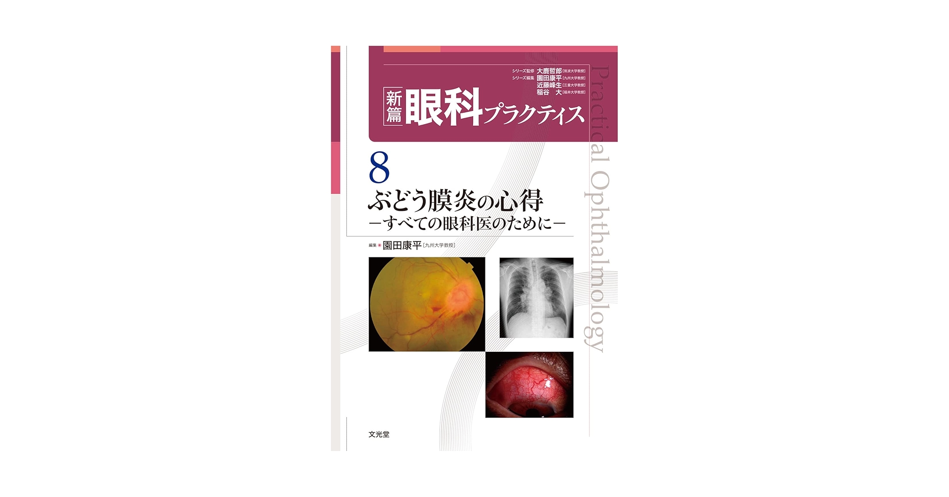 [裁断済]ぶどう膜炎の心得 (新篇眼科プラクティス 8) ぶどう膜炎の心得 (新篇眼科プラクティス 8) | 園田康平 |本
