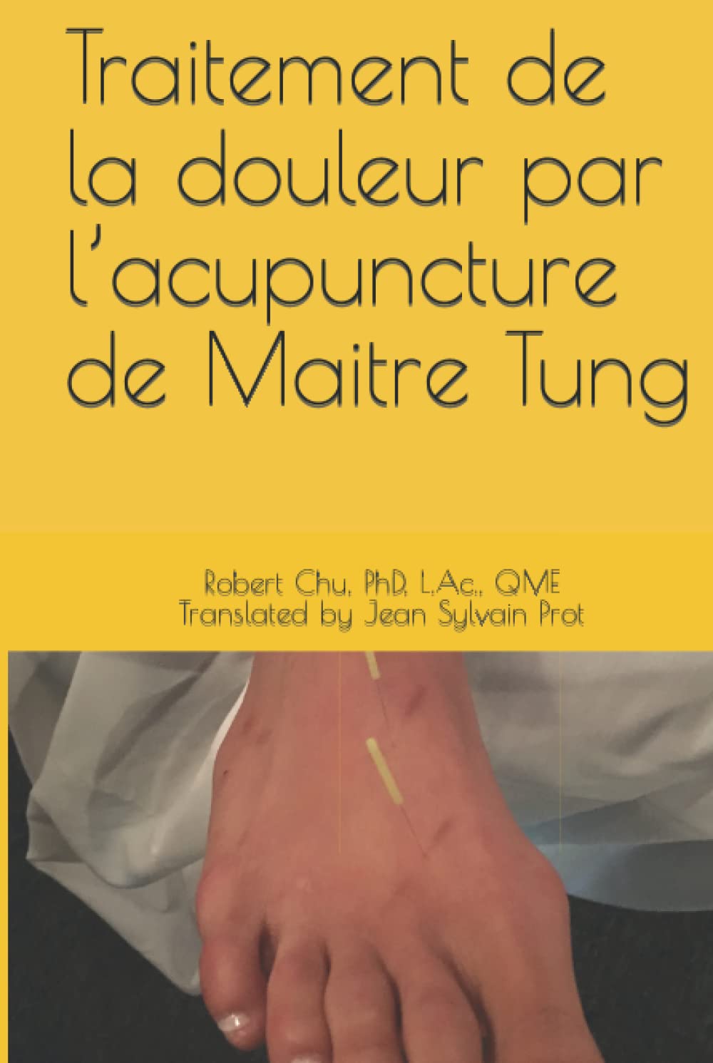 Traitement de la douleur par l’acupuncture de Maitre Tung
